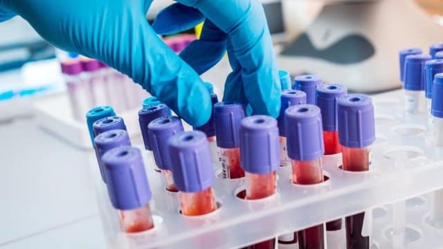 Seferihisar'da Corona Virüsü teşhisi yok 1 turkiye sinirinda virus alarmi 1532084402